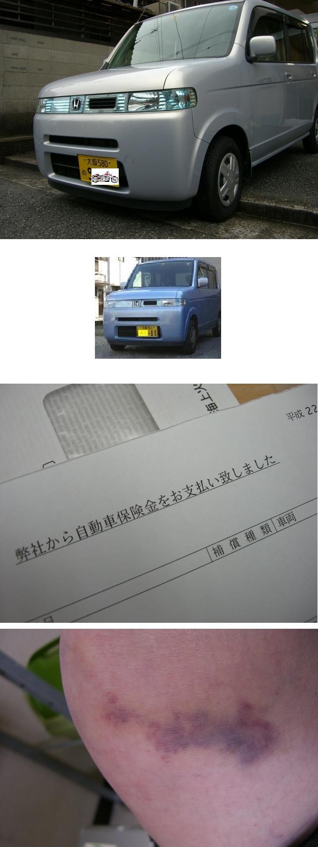 注意1秒 事故ショック えいとさんのお気楽日常 クックパッドブログ 注意1秒 事故ショック えいとさんのお気楽日常 クックパッドブログ