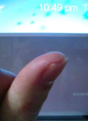 包丁で指切った W O W ｍａｒｉ のごはん日記