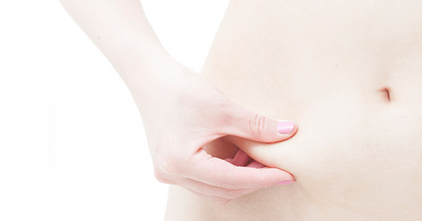 ダイエットに成功したけど 肉割れ が どうすれば クックパッドニュース ダイエットに成功したけど 肉割れ が どうすれば クックパッドニュース