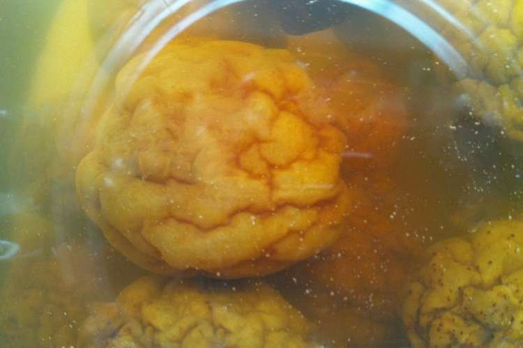 梅の蜂蜜漬け レシピ 作り方 By Noanoanoan クックパッド 簡単おいしいみんなのレシピが358万品